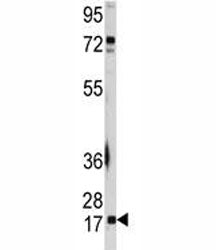 UBC9 Antibody (UBE2I)