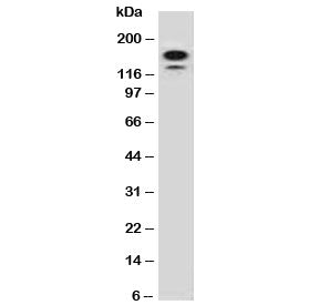 Western blot testing of human HeLa lysate with MSH6 antibody (clone MTS6-1). Expected molecular weig