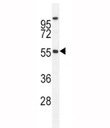 BMP4 antibody western blot analysis in MDA-MB435 lysate. Predicted molecular weight: 54 kDa (precurs