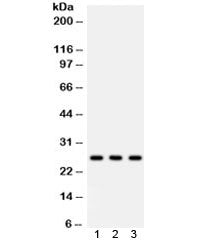 Western blot testing of 1) rat lung, 2) mouse lung, 3) A549 lysate with SFTPA1/2 antibody. Predicted