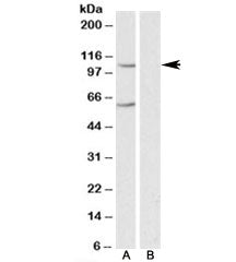 IRP2 Antibody
