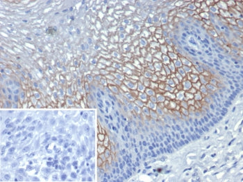 IHC staining of FFPE human esophagus tissue with SBSN antibody (clone SBSN/7961). Inset: PBS used in