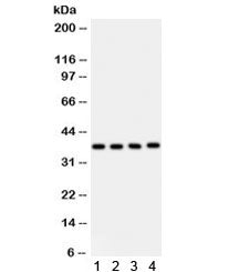 Western blot testing of 1) human placenta, 2) HeLa, 3) HUT and 4) Jurkat lysate with PINX1 antibody.