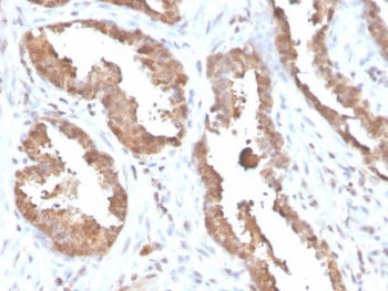 MIF Antibody / Macrophage migration inhibitory factor