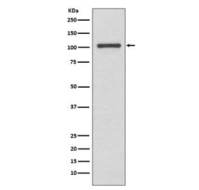 Western blot testing of human MCF7 cell lysate with INPP4B antibody. Predicted molecular weight ~105