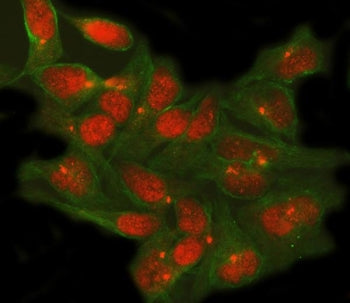Immunofluorescent staining of FFPE human HeLa cells with TSHZ1 antibody (red) and Alpha Tubulin mAb 