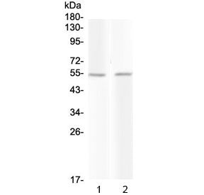 PROC Antibody / Protein C