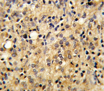 COMP Antibody / TSP5