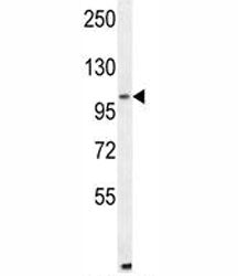 ALDH1L2 Antibody