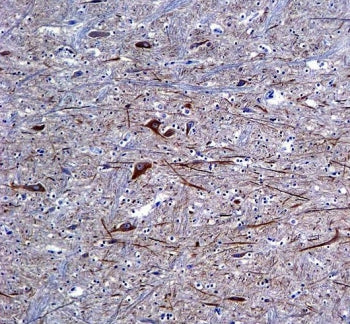 IHC testing of FFPE human brain tissue with Neurofilament-66 antibody. HIER: steam section in pH6 ci