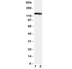 Collagen II Antibody / COL2A1