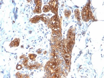 MUC1 Antibody / Mucin-1