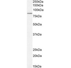 TG2 Antibody