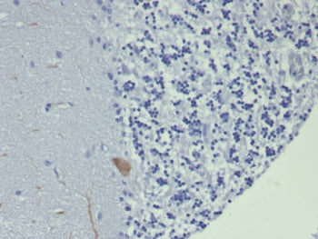 GIRK2 Antibody / KCNJ6
