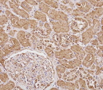 Cortisol Binding Globulin Antibody / CBG / SERPINA6