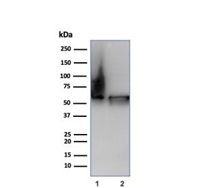 Western blot testing of human 1) Hep2 and 2) HeLa cell lysate using HSP60/GROEL antibody (clone HSPD