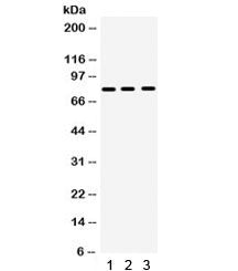 Western blot testing of 1) rat NRK, 2) mouse ANA-1 and 3) mouse HEPA cell lysate with MMP9 antibody.