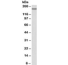 Western blot testing of HeLa lysate with EGFR antibody at 0.1ug/ml. Predicted molecular weight ~134k