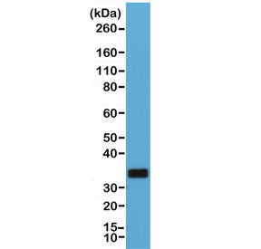 CD20 Antibody
