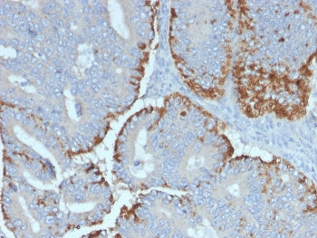 ATG5 Antibody