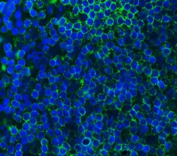 Immunofluorescent staining of FFPE mouse intestinal lymph node cells with Cd79a antibody (green) and