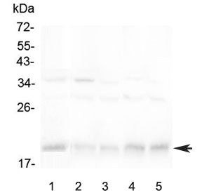 BAFF Receptor Antibody / BAFF-R