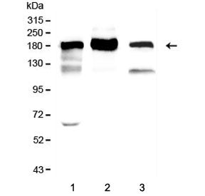 Western blot testing of 1) rat lung, 2) mouse lung and 3) Raji lysate with ACE antibody. Expected mo