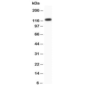 Progesterone Receptor Antibody
