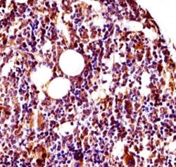 Lyn antibody immunohistochemistry analysis in formalin fixed and paraffin embedded mouse bone (femur