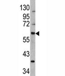 MDM2 Antibody