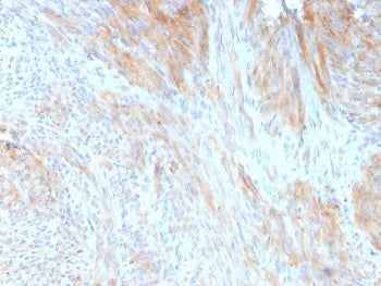 Aciculin Antibody / Phosphoglucomutase 5
