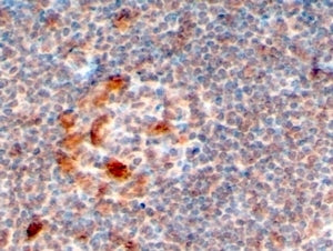 ZCCHC11 Antibody