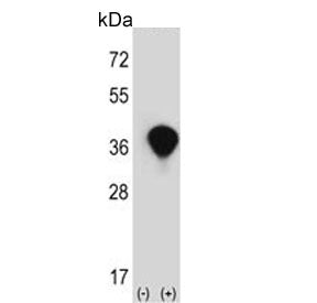 Transaldolase Antibody / TALDO1