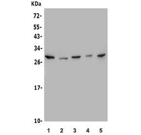 MESP1 Antibody / Mesoderm Posterior Protein 1
