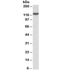 Western blot testing of spleen lysate with ADAM19 antibody at 0.1ug/ml. Predicted molecular weight: 