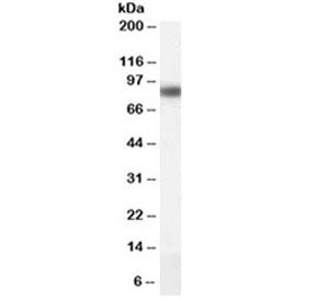 CPT1A Antibody