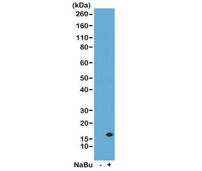 H3K14ac Antibody / Acetyl Histone H3 Lysine 14