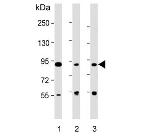 Western blot testing of human 1) HT-1080, 2) K562 and 3) RPMI 8226 cell lysate with DIEXF antibody. 