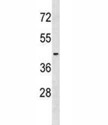 S1PR2 Antibody