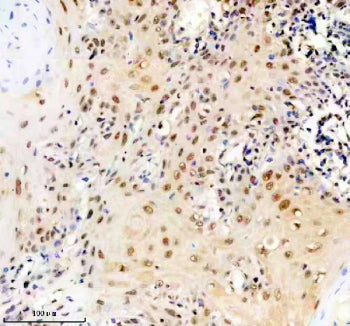 ERCC2 Antibody / DNA excision repair protein ERCC-2 / XPD, 100ul