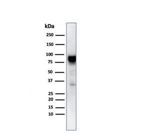 Western blot testing of human MCF7 cell lysate with HSP90AB1 antibody. Expected molecular weight: 84