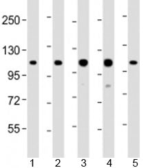 RAD54B Antibody