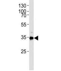 Western blot analysis of lysate from HUVEC cell line using Gapdh antibody. Ab was diluted at 1:1000.