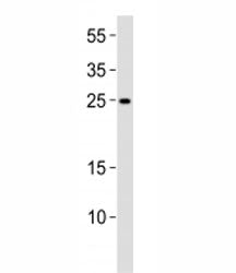 RAB27A Antibody
