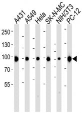Western blot analysis of lysate from A431, A549, HeLa, SK-N-MC, mouse NIH3T3, rat PC-12 cell line us