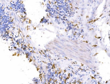 SH3GL2 Antibody / Endophilin A1