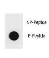 Phospho-PTEN Antibody (pY315)
