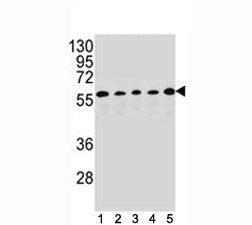 PAX1 Antibody