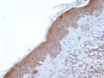 IHC staining of FFPE human skin tissue with SERPINB5 antibody (clone SERPINB5/4971). HIER: boil tiss
