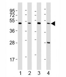 CTBP1 Antibody